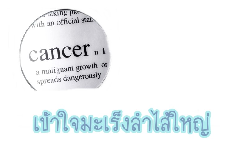 สารคดีสุขศึกษา - เข้าใจมะเร็งลำไส้ใหญ่